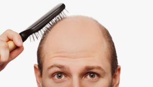 Клиники воронежа по выпадению волос